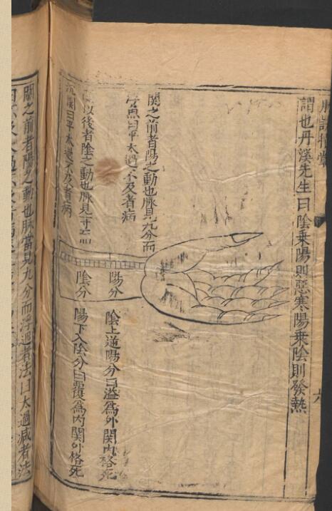 新刻校定脉诀指掌病式图说