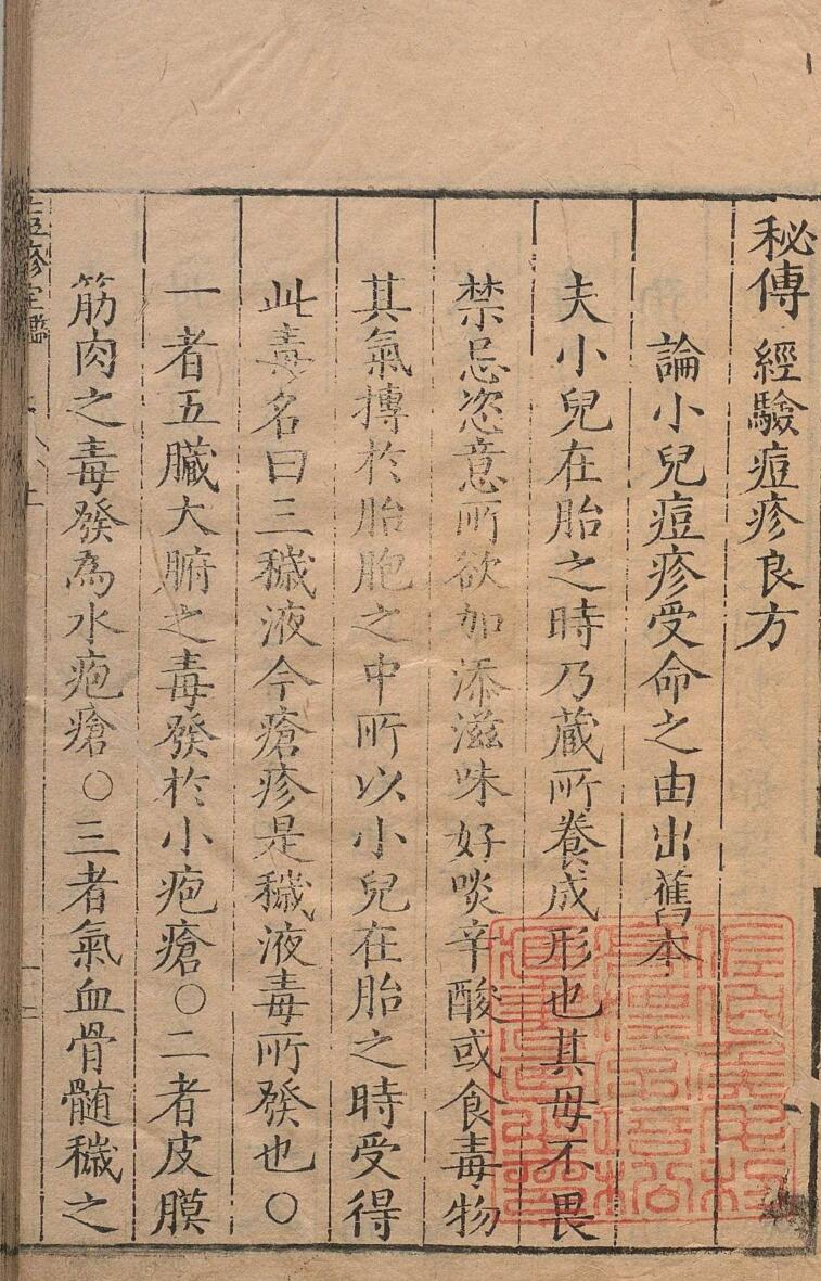 秘传经验痘疹良方 ３卷 明刊本